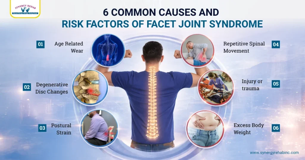 6 Common Causes and Risk Factors of Facet Joint Syndrome