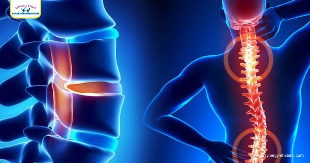 Symptoms That Suggest Facet Joint Involvement